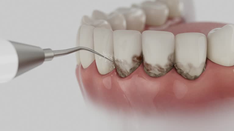 Reliable Dental Implants contractor in Kingston, NJ by Smile Center Dentistry